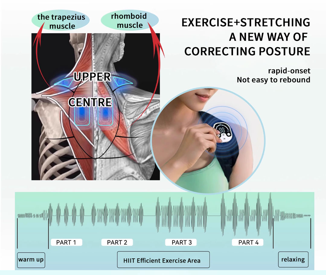 Microcurrent Posture Device Fo - Posture Corrector Back บทวิจารณ์และราคา